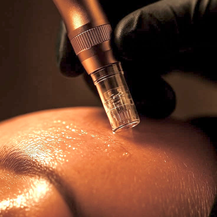 MESOHEAL® GLOW SERIE : PROTOCOLOS DE REVITALIZACIÓN Y LUMINOSIDAD PARA UNA PIEL RADIANTE ( PACK 3 SESIONES )