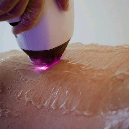 DEPILACIÓN LÁSER: TECNOLOGÍA AVANZADA PARA UNA PIEL MÁS SUAVE, CÓMODA Y LIBRE DE VELLO