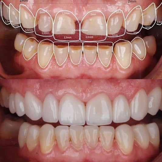 DISEÑO SONRISA DIGITAL : PORQUE TU SONRISA ES ÚNICA